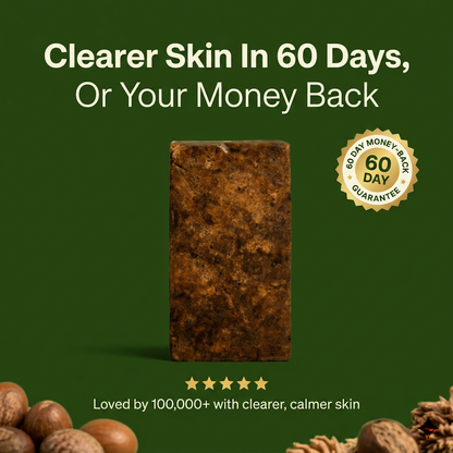 Anti-Acne & Blemish Bar.